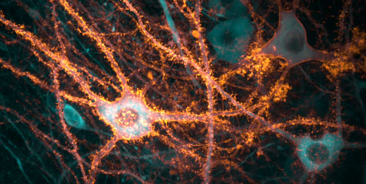 Neurons in the hippocampus, the brain’s memory centre. Amber marks light-sensitive molecules used to control the cells, while turquoise reveals their activity. 